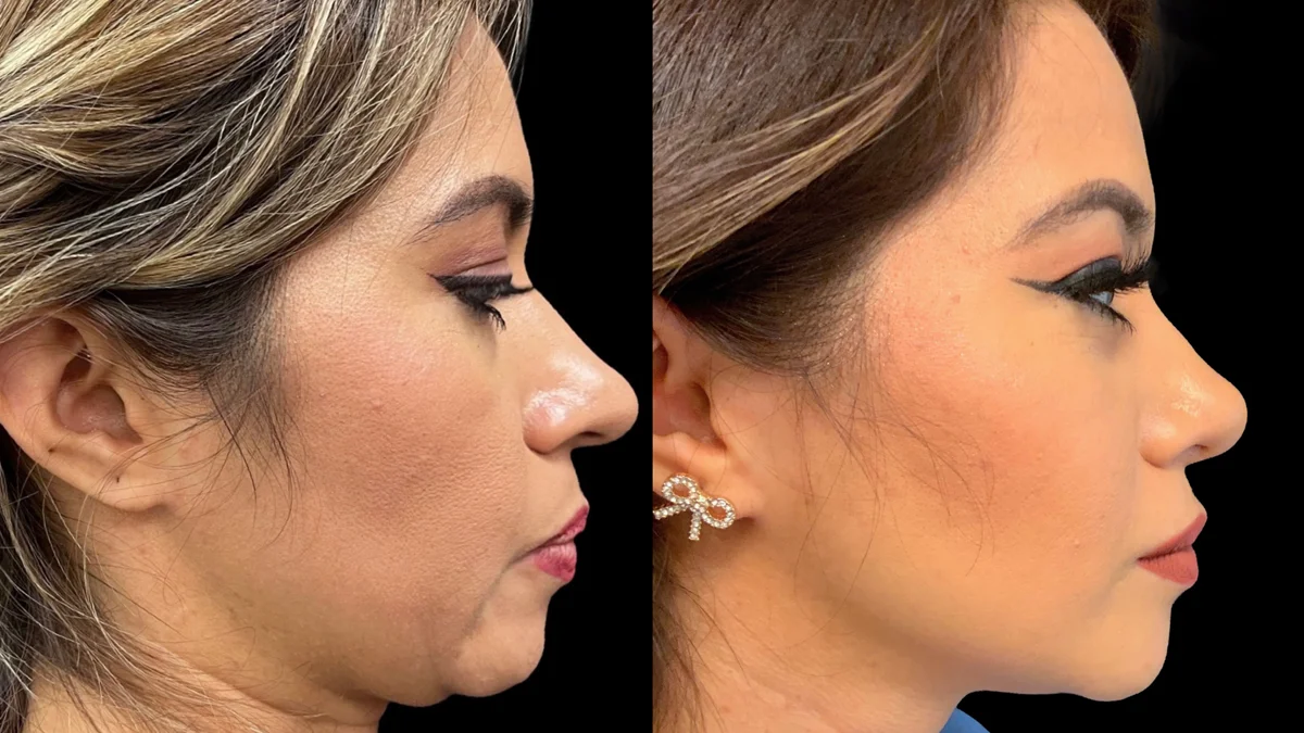 46EDBE9E-672B-4BD7-9D9F-6A1F4FC7AF4E copy