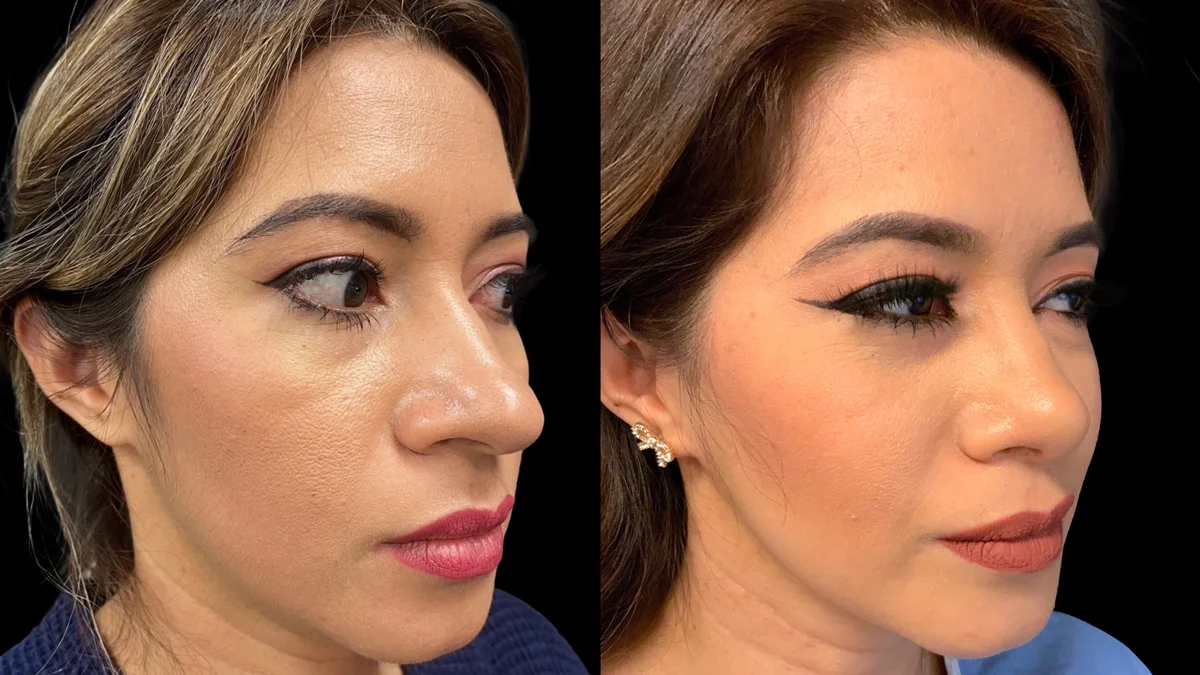 B2481CFE-FFDA-45EC-B686-315ABFD2EFD4 copy