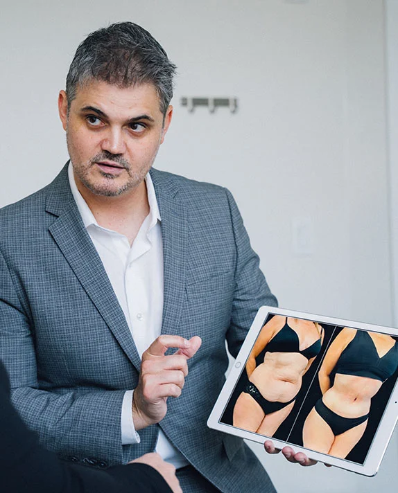 Dr. Pathak explains a procedure using a tablet displaying abdomen transformation photos, illustrating the results of awake liposuction techniques.
