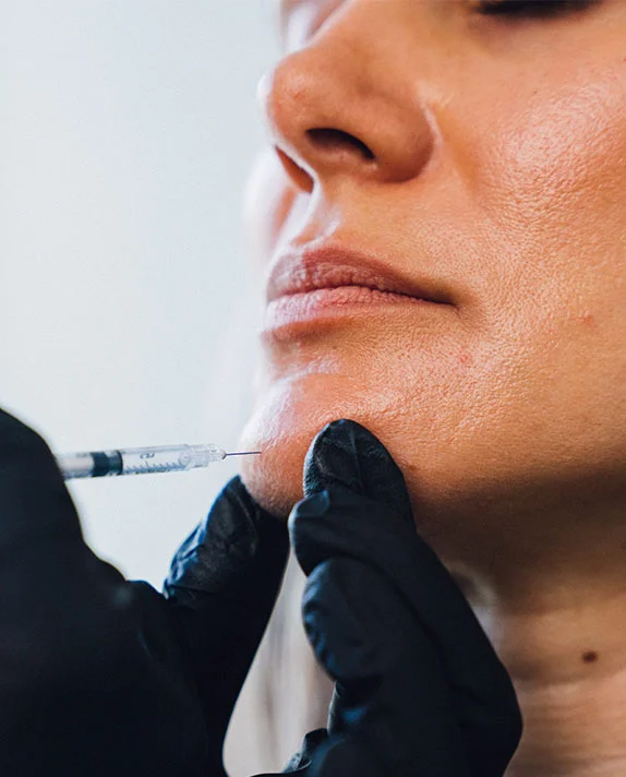 An extreme close-up of a patient’s lower face as a practitioner in black gloves performs a dermal filler injection into the chin area.