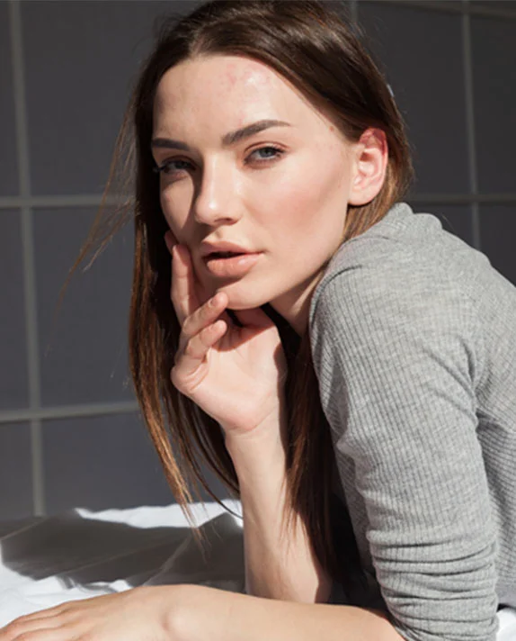 A young woman with light brown hair rests her chin on her hand, looking directly at the camera in bright light.